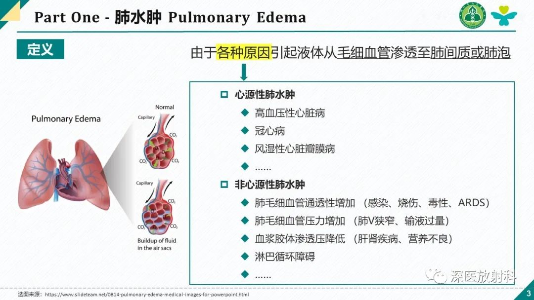影像PPT - 【PPT】肺水肿、ICU影像及肺癌-3