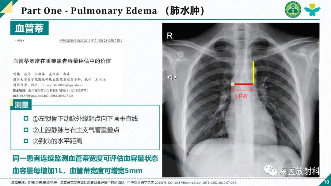 影像PPT - 【PPT】肺水肿、ICU影像及肺癌-10
