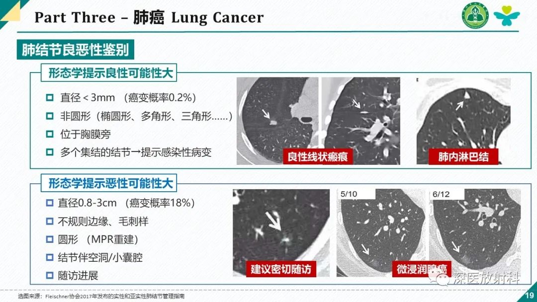 影像PPT - 【PPT】肺水肿、ICU影像及肺癌-19