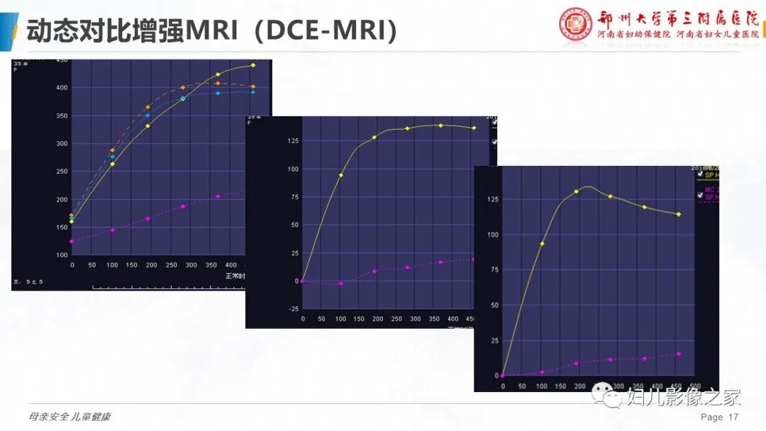 影像PPT - 【PPT】MRI新技术在乳腺疾病诊断中的应用-17