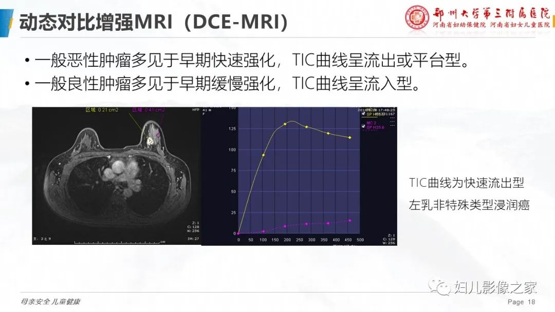 影像PPT - 【PPT】MRI新技术在乳腺疾病诊断中的应用-18