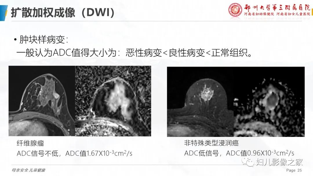 影像PPT - 【PPT】MRI新技术在乳腺疾病诊断中的应用-25