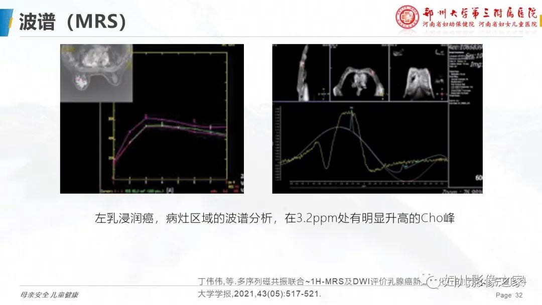 影像PPT - 【PPT】MRI新技术在乳腺疾病诊断中的应用-32