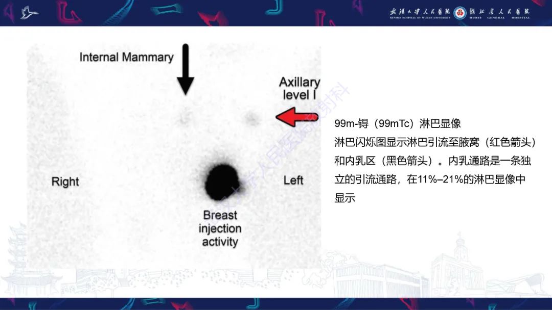 影像PPT - 【PPT】乳腺癌淋巴结影像评估-22