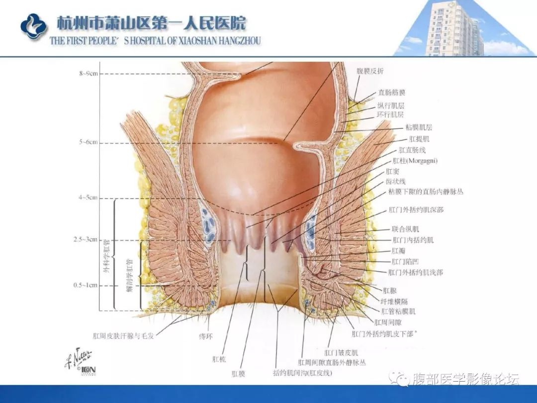 影像PPT - 【PPT】肛瘘MRI诊断-5 影像PPT - 【PPT】肛瘘MRI诊断-5