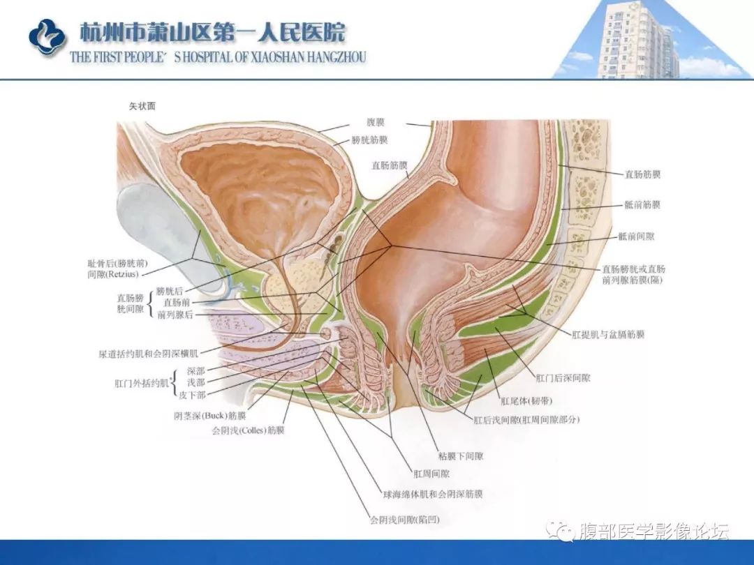 影像PPT - 【PPT】肛瘘MRI诊断-6 影像PPT - 【PPT】肛瘘MRI诊断-6