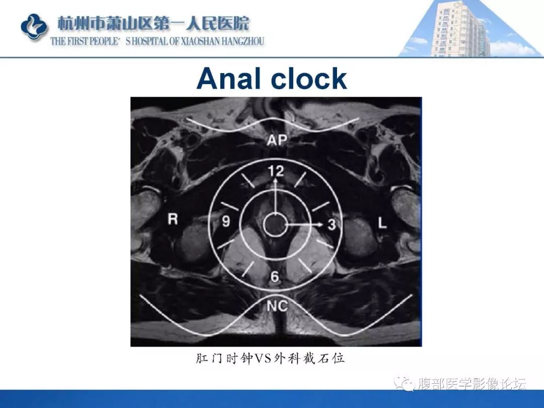影像PPT - 【PPT】肛瘘MRI诊断-18 影像PPT - 【PPT】肛瘘MRI诊断-18