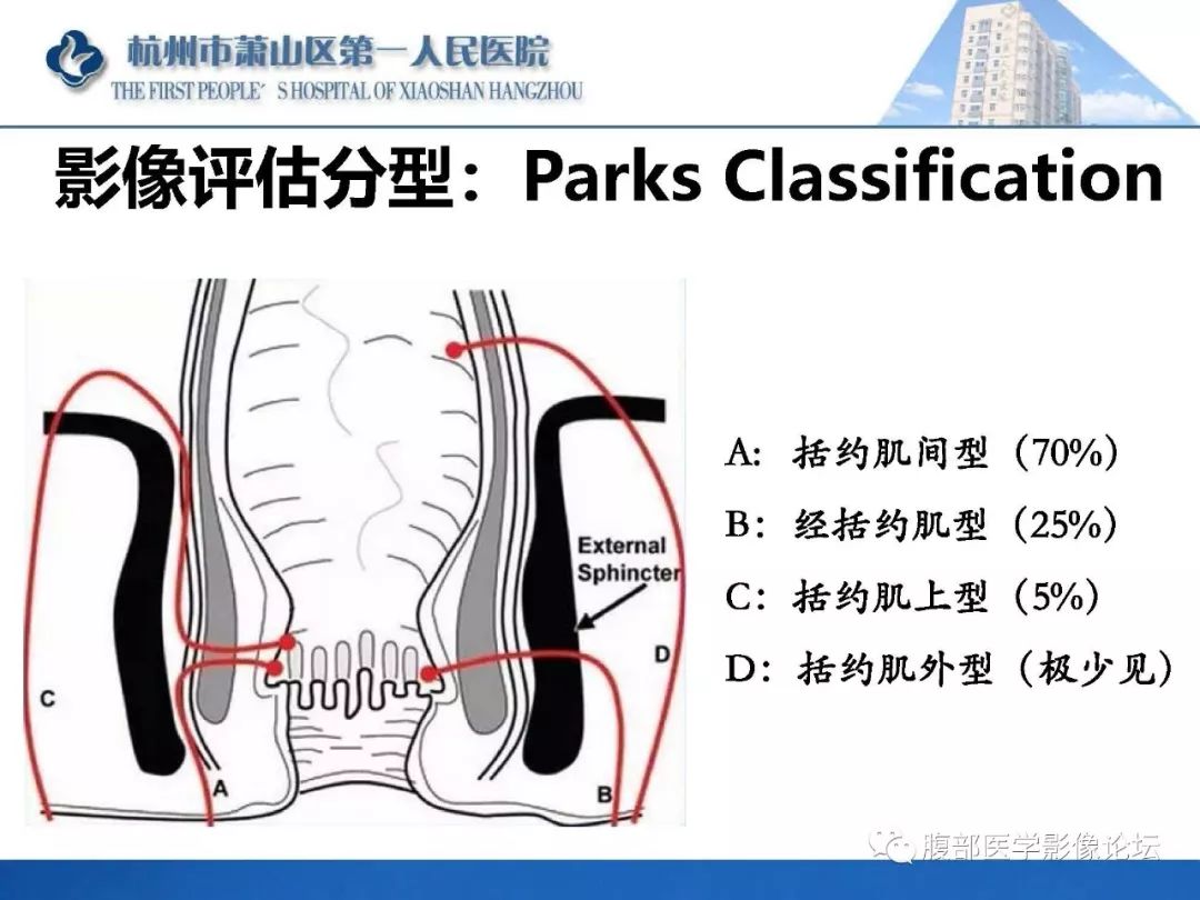 影像PPT - 【PPT】肛瘘MRI诊断-19 影像PPT - 【PPT】肛瘘MRI诊断-19