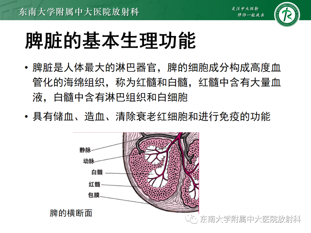 影像PPT - 【PPT】脾脏先天性变异-4