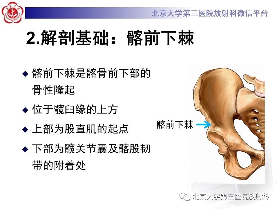 影像PPT - 【PPT】髋关节髂前下棘撞击-8