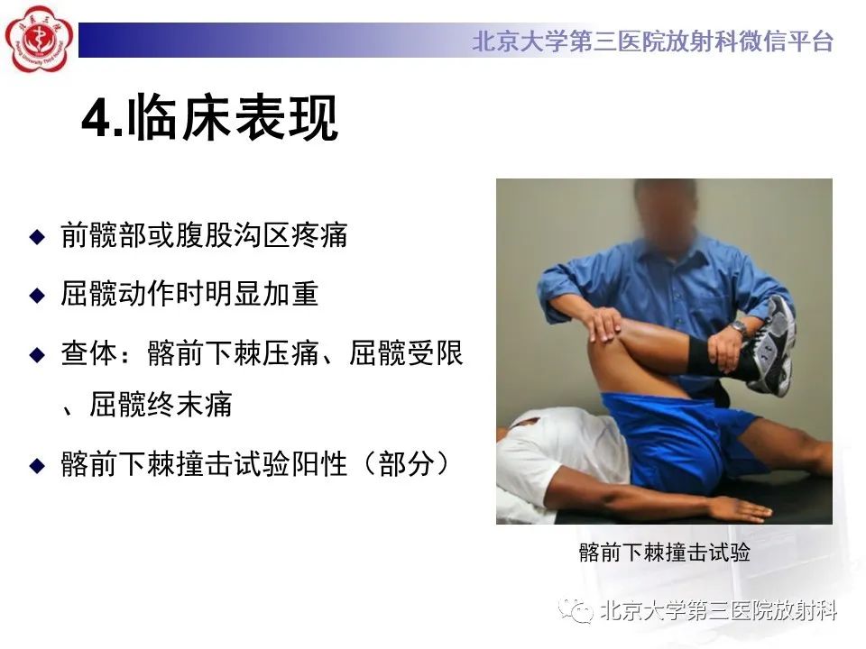 影像PPT - 【PPT】髋关节髂前下棘撞击-21