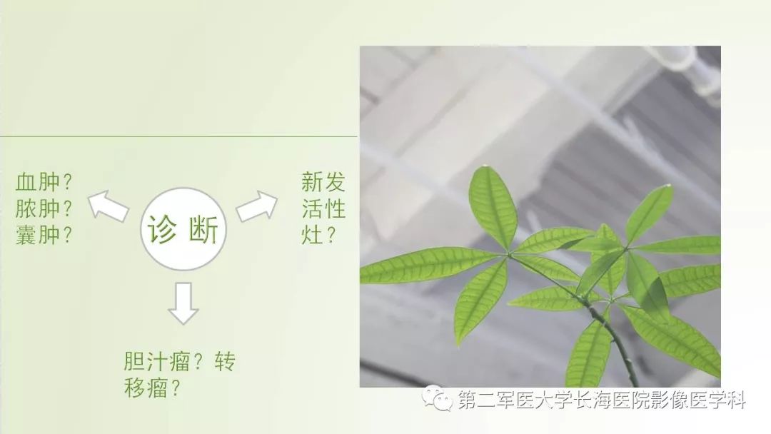影像PPT - 【PPT】胆汁瘤的影像诊断与临床处理-15