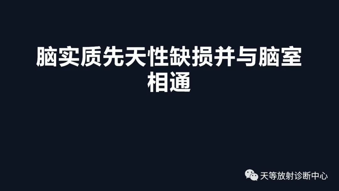 影像PPT - 【病例】脑穿通畸形1例MR影像-1 影像PPT - 【病例】脑穿通畸形1例MR影像-1