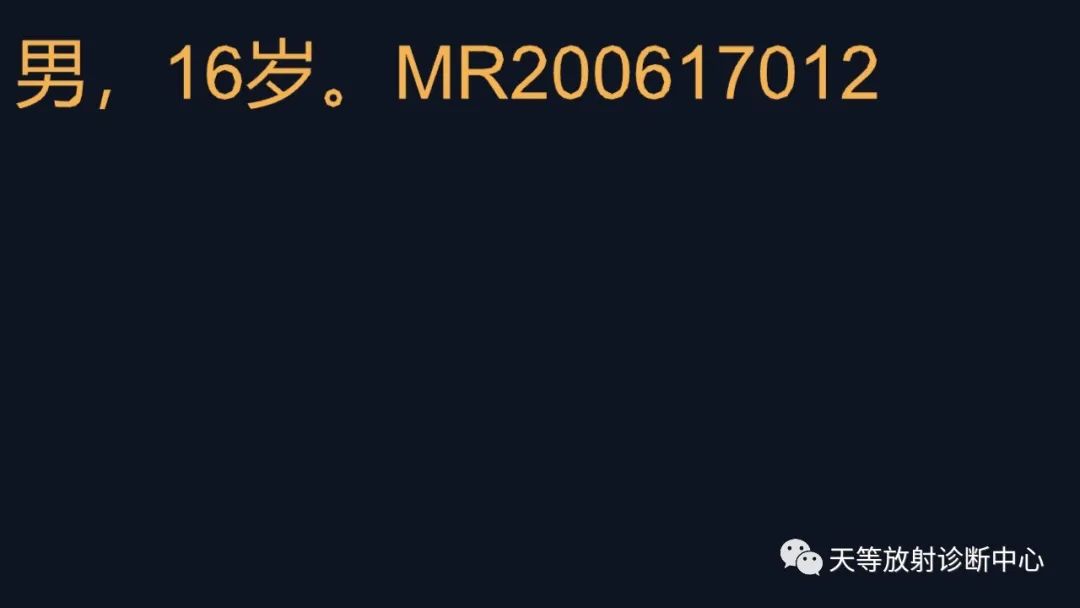 影像PPT - 【病例】脑穿通畸形1例MR影像-2 影像PPT - 【病例】脑穿通畸形1例MR影像-2
