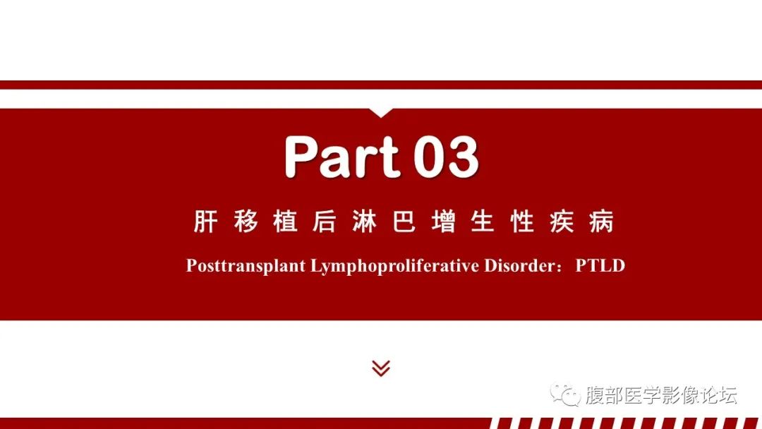 影像PPT - 【PPT】肝脏血液系统疾病影像综述-34