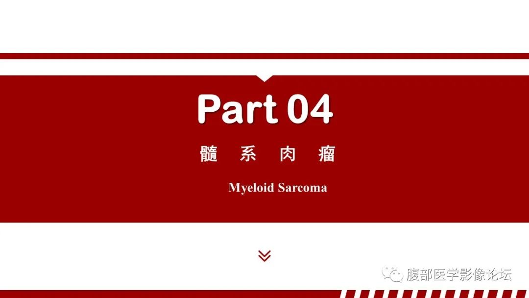 影像PPT - 【PPT】肝脏血液系统疾病影像综述-50