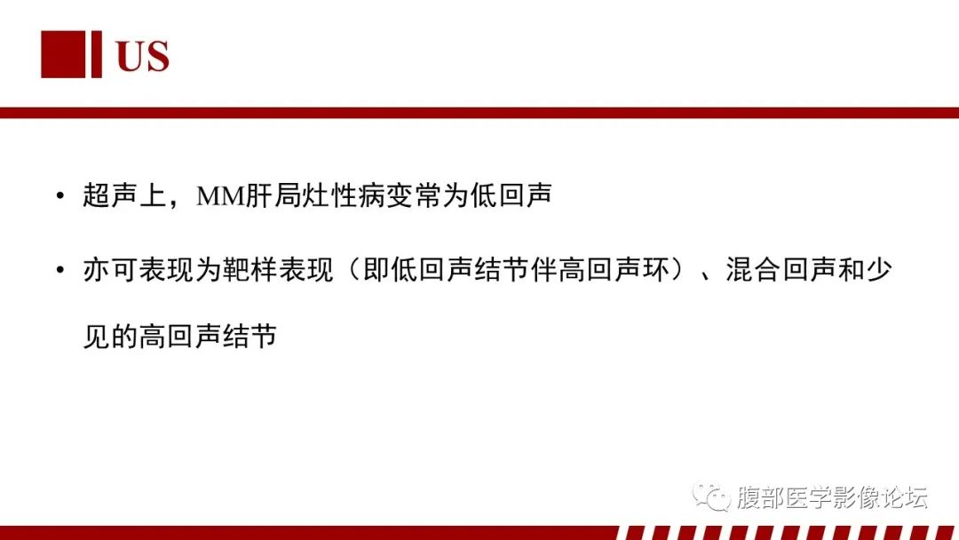 影像PPT - 【PPT】肝脏血液系统疾病影像综述-72