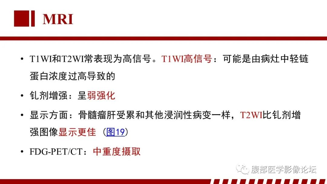 影像PPT - 【PPT】肝脏血液系统疾病影像综述-75
