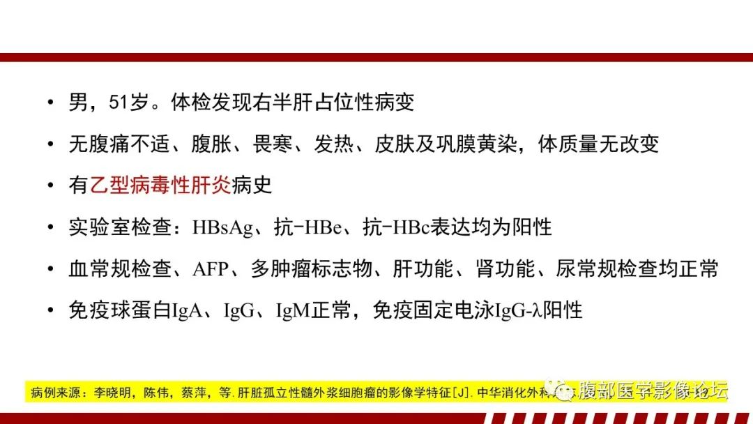 影像PPT - 【PPT】肝脏血液系统疾病影像综述-85