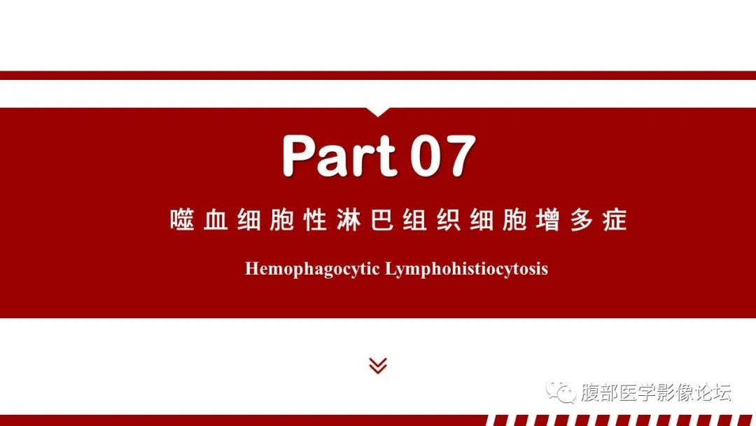 影像PPT - 【PPT】肝脏血液系统疾病影像综述-109