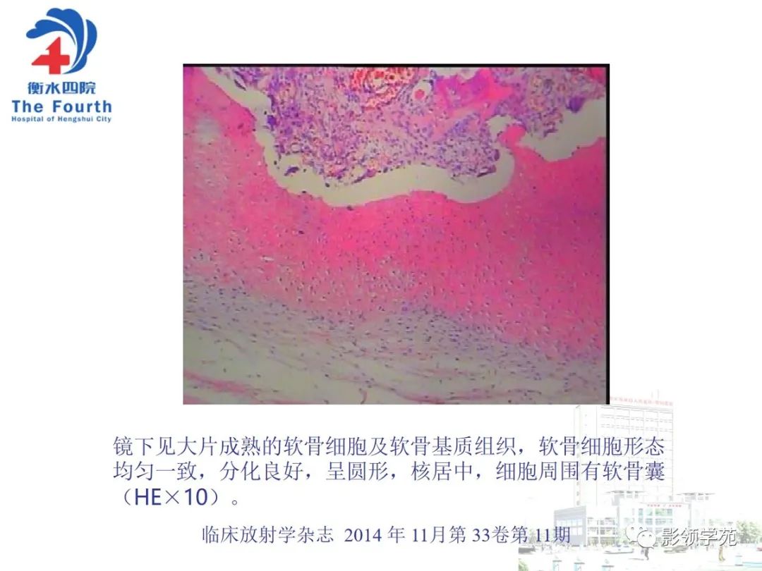 影像PPT - 【PPT】髌骨肿瘤的影像特点-25 影像PPT - 【PPT】髌骨肿瘤的影像特点-25