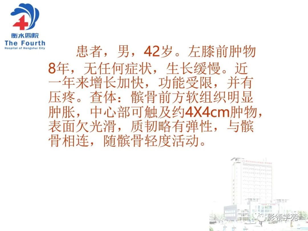 影像PPT - 【PPT】髌骨肿瘤的影像特点-27 影像PPT - 【PPT】髌骨肿瘤的影像特点-27