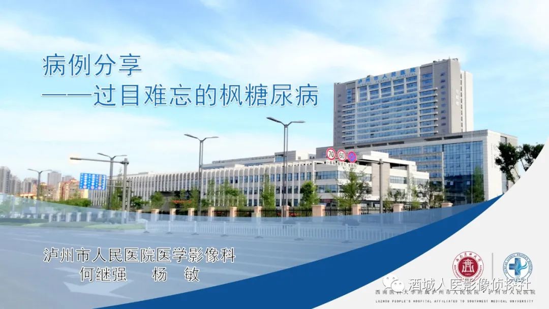 影像PPT - 【PPT】过目难忘的枫糖尿病-1