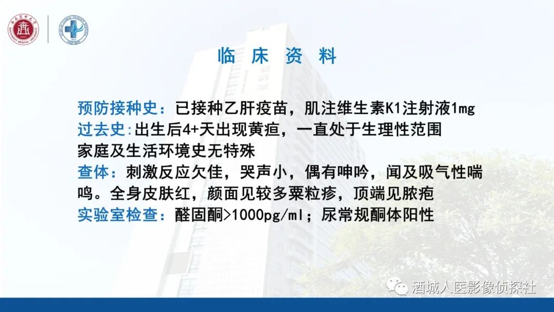 影像PPT - 【PPT】过目难忘的枫糖尿病-3