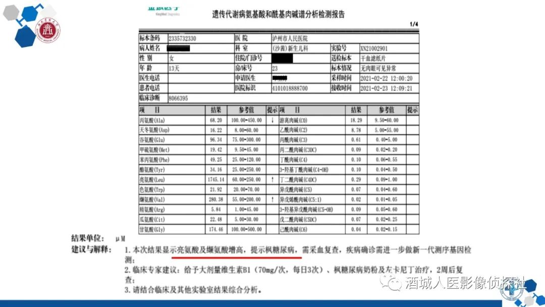 影像PPT - 【PPT】过目难忘的枫糖尿病-9