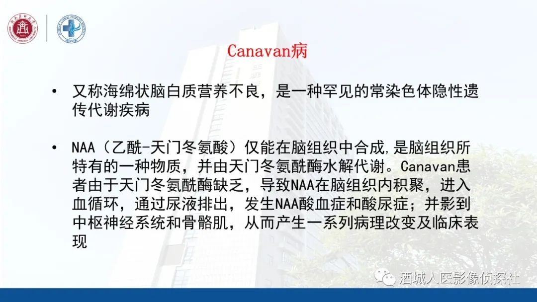 影像PPT - 【PPT】过目难忘的枫糖尿病-28