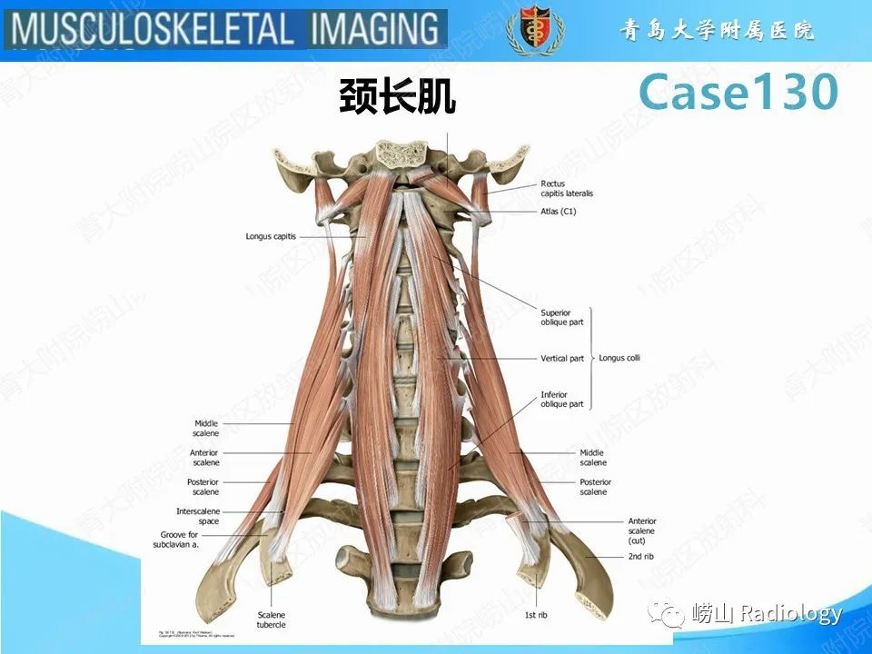 影像PPT - 【PPT】C2过伸骨折-9