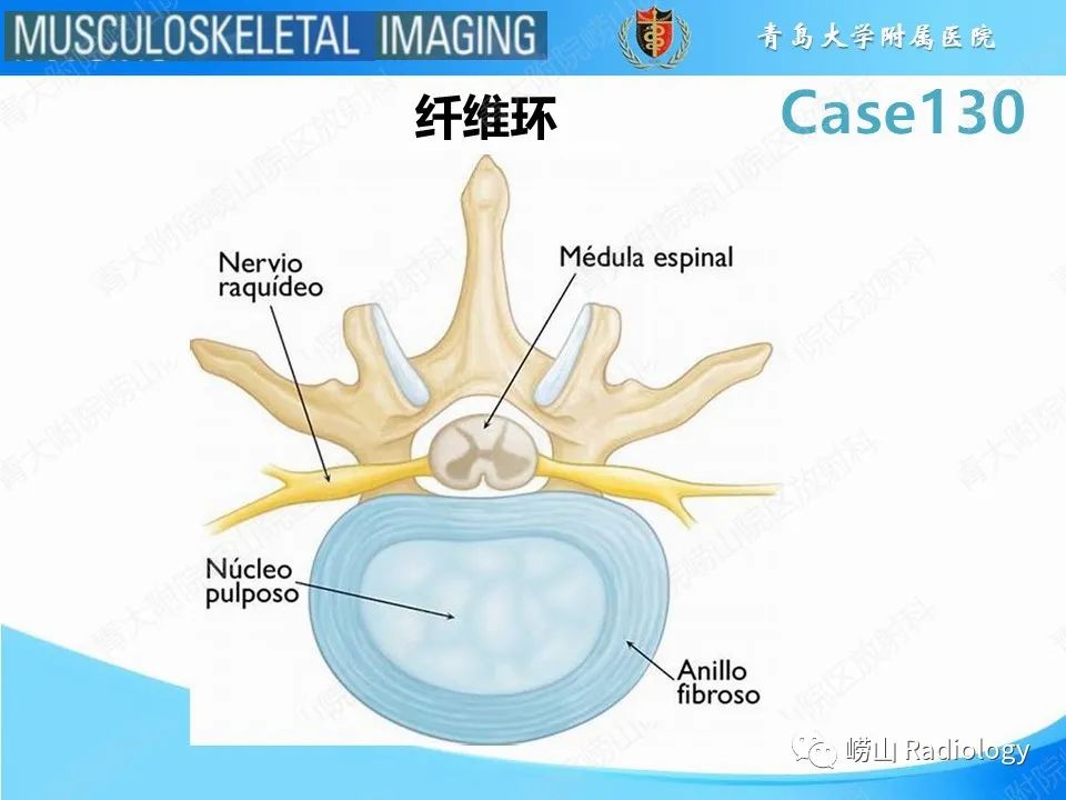 影像PPT - 【PPT】C2过伸骨折-11