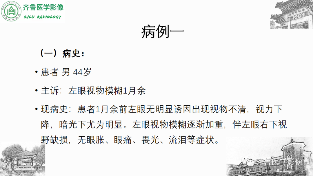 影像PPT - 【PPT】眼与眼眶病变—脉络膜黑色素瘤-2