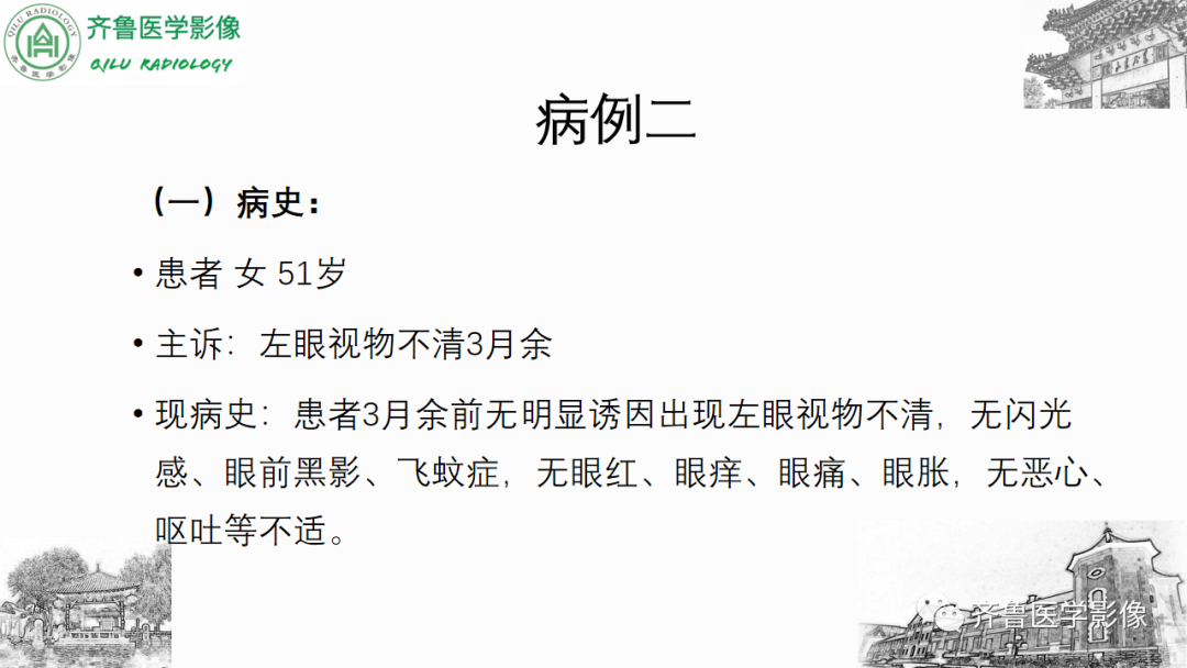 影像PPT - 【PPT】眼与眼眶病变—脉络膜黑色素瘤-6