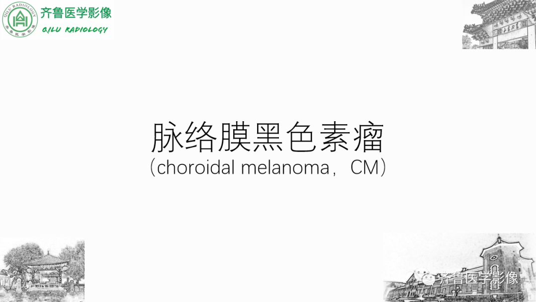影像PPT - 【PPT】眼与眼眶病变—脉络膜黑色素瘤-9