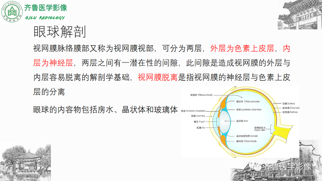 影像PPT - 【PPT】眼与眼眶病变—脉络膜黑色素瘤-11