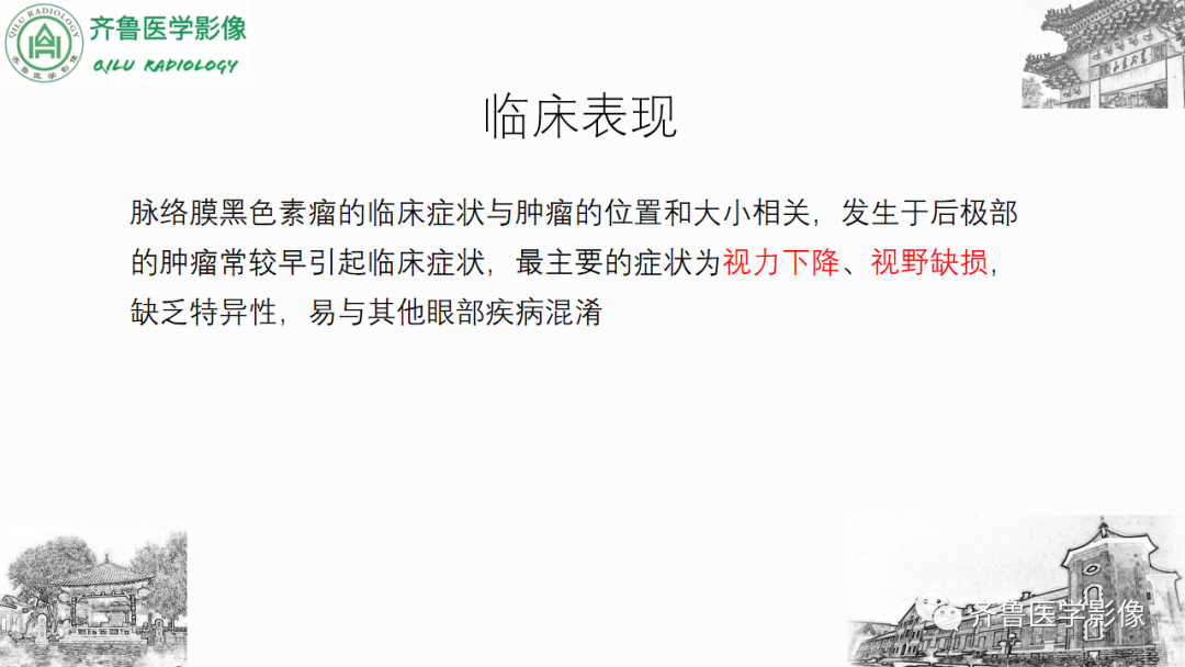 影像PPT - 【PPT】眼与眼眶病变—脉络膜黑色素瘤-13