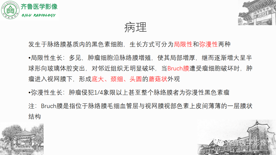 影像PPT - 【PPT】眼与眼眶病变—脉络膜黑色素瘤-14
