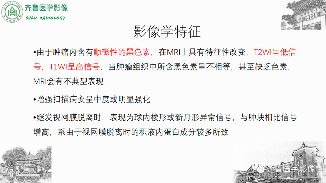 影像PPT - 【PPT】眼与眼眶病变—脉络膜黑色素瘤-19