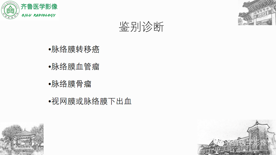 影像PPT - 【PPT】眼与眼眶病变—脉络膜黑色素瘤-25