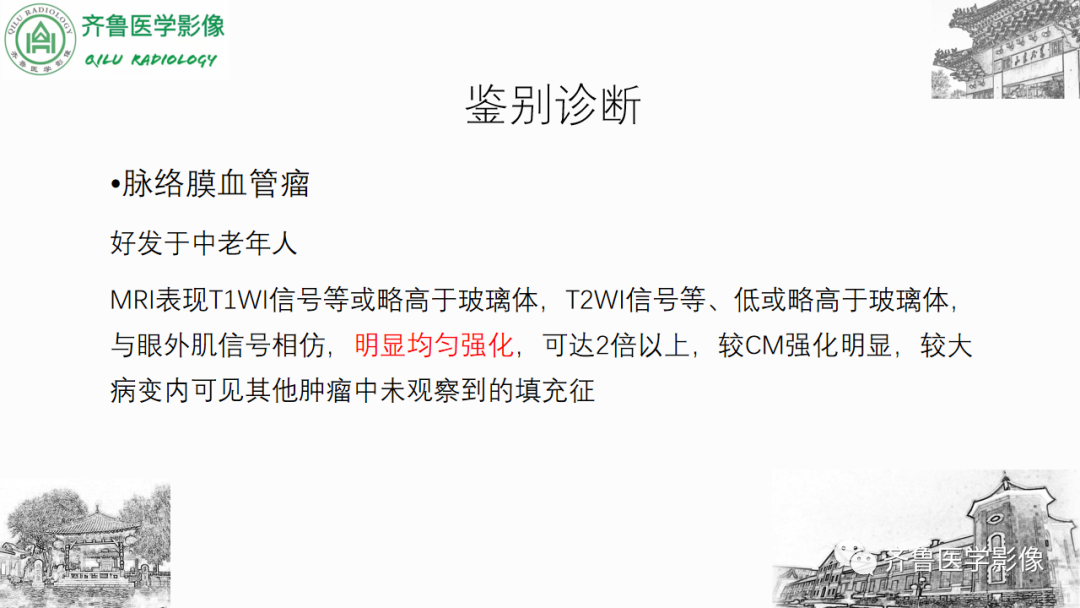 影像PPT - 【PPT】眼与眼眶病变—脉络膜黑色素瘤-29