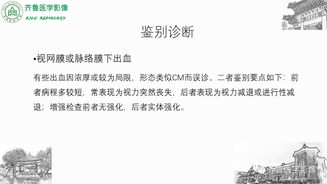 影像PPT - 【PPT】眼与眼眶病变—脉络膜黑色素瘤-33
