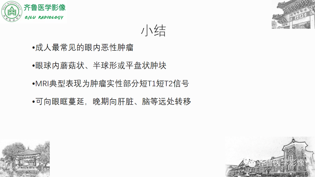 影像PPT - 【PPT】眼与眼眶病变—脉络膜黑色素瘤-35