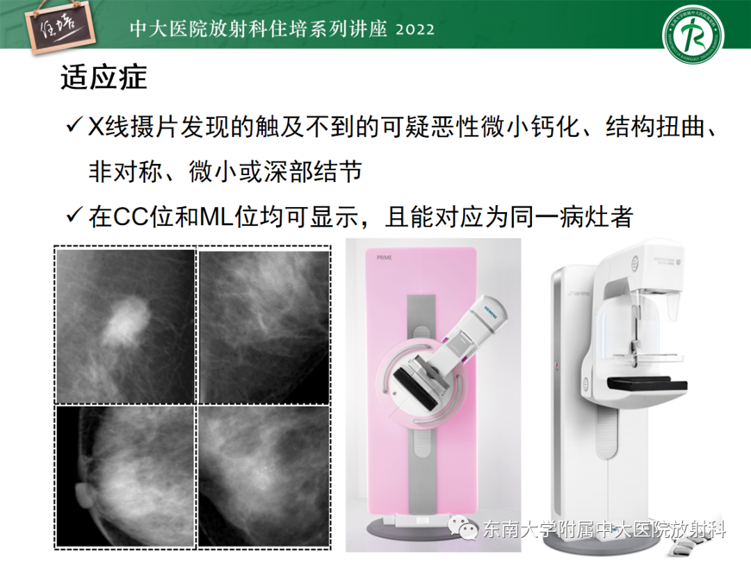 影像PPT - 【PPT】X线引导下乳腺病灶的术前定位-4