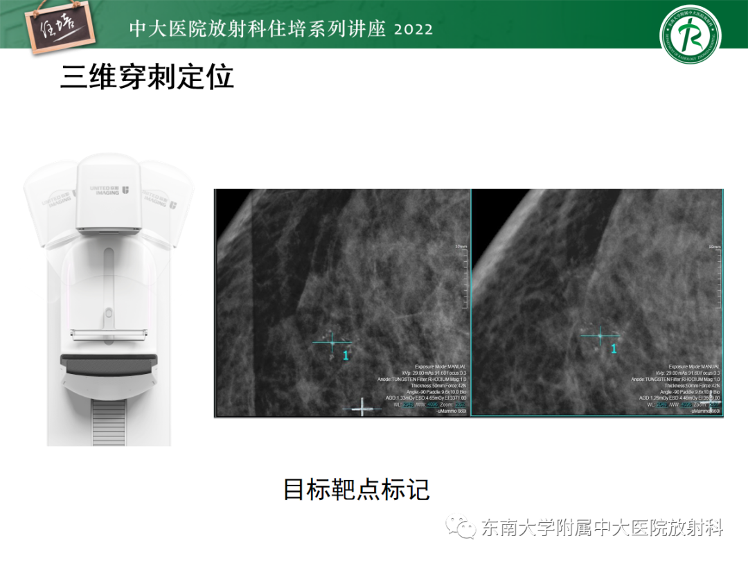 影像PPT - 【PPT】X线引导下乳腺病灶的术前定位-18