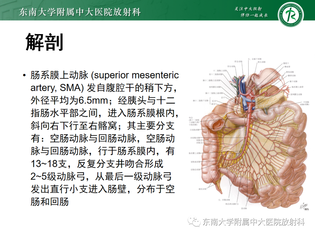 影像PPT - 【PPT】孤立性肠系膜上动脉夹层-4