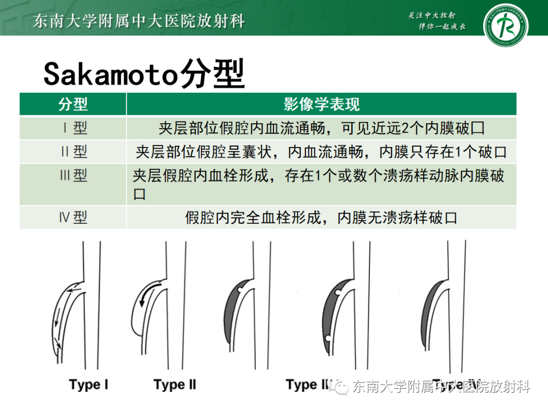 影像PPT - 【PPT】孤立性肠系膜上动脉夹层-14