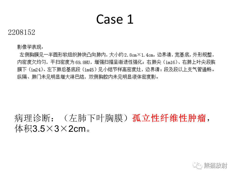 影像PPT - 【病例】胸膜孤立性纤维瘤 VS 胸壁神经鞘瘤-14
