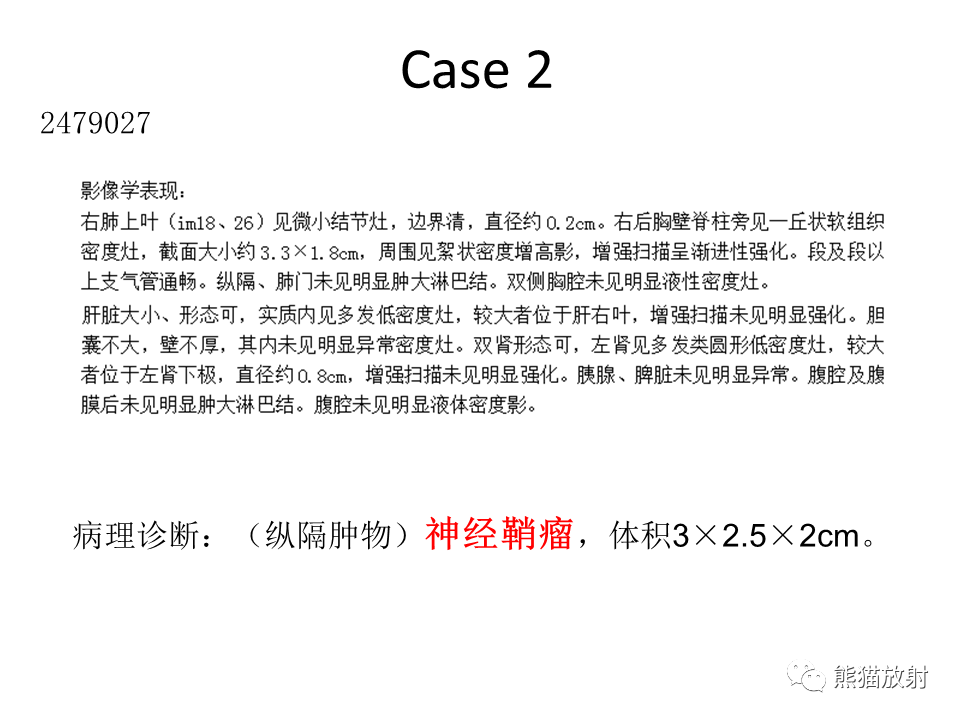 影像PPT - 【病例】胸膜孤立性纤维瘤 VS 胸壁神经鞘瘤-15