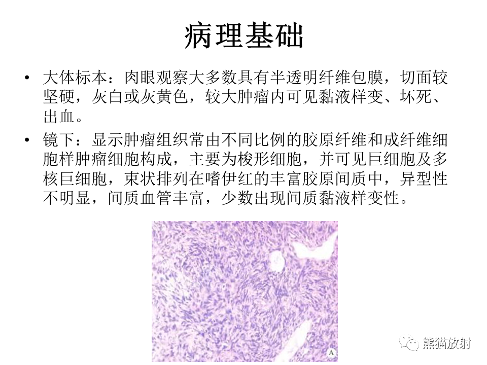 影像PPT - 【病例】胸膜孤立性纤维瘤 VS 胸壁神经鞘瘤-18